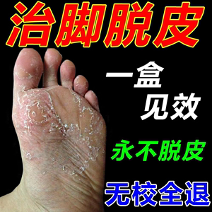 治疗手脚脱皮皮脚底脚心痒掉专用膏烂脚丫干裂燥去除老茧药去死皮