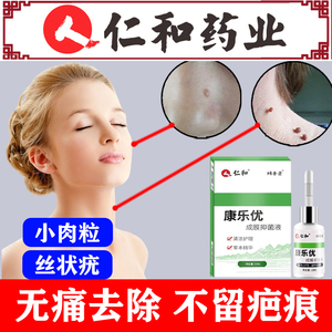 去脖子脸上长肉粒疙瘩皮赘小肉瘤点丝状疣痣揪祛肉球膏瘊子腋下尤