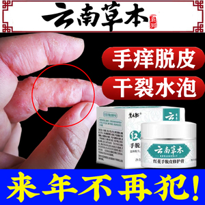 手鲜药膏真菌感染