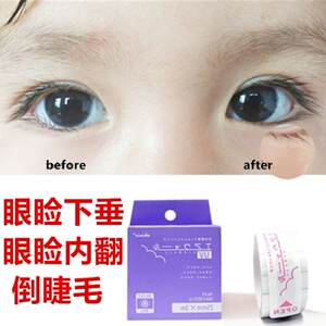 下垂眼贴
