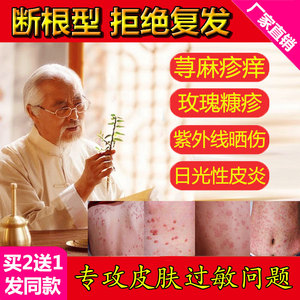 正品vg软膏日本原装牛皮美孚美浮特皮肤抗菌液官网疗霉舒凝胶止痒