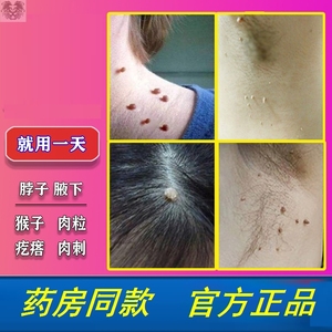 000人付款淘宝去猴子的祛除点腋下脖子身上长小肉粒疙瘩肉瘤揪皮赘