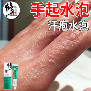 00阿里健康大药房天猫手气脚癣皮藓药膏手足癣药水外阴真菌感染手癣