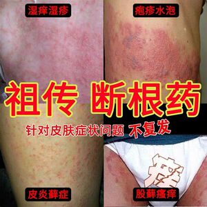 男女外阴囊湿疹止痒中药膏皮炎皮肤外用瘙痒抑菌过敏红疹私处专用