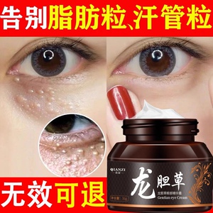 脂肪粒去除神器眼部颗粒专用膏祛除汗管粒脸部鼻子药去油脂粒眼霜