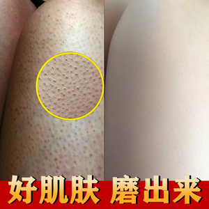 磨砂膏嫩白全身沐浴露保湿去背部痘痘鸡皮疙瘩毛囊角质美身体乳去