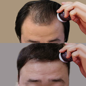 moeta男士修饰发际线补发前额m阴影粉填充笔神器头顶头发稀少遮盖