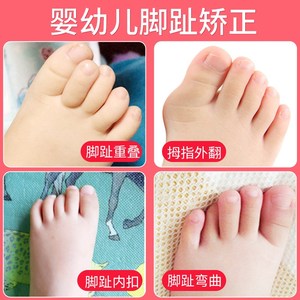 婴儿童脚趾头矫正器重叠分趾器纠正神器宝宝拇指外翻专用小孩幼儿