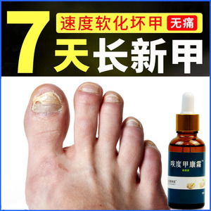 治疗灰指甲专用药正品脱甲精油软化膏杀菌液灰甲净非亮甲旗舰店