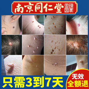 tb441721796000淘宝跖疣猴子刺猴瘊子正品专用肉粒疙瘩肉刺非净去尤