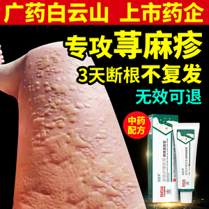 皮肤药膏止痒过敏