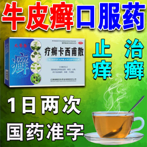 牛皮癣药特疗癣卡西甫散治体癣股癣全身痒皮肤瘙痒效燥湿止痒药zm