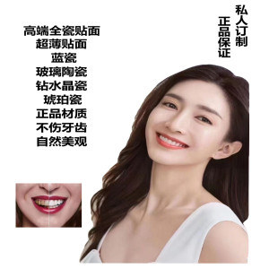 义获嘉超薄明星全瓷贴面冰蓝瓷烤瓷牙粘接修复美牙琥珀瓷全瓷贴片