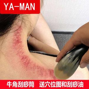 牛角刮痧后背