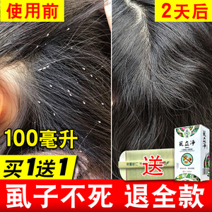 虱子药儿童头虱子一扫光小女孩头发虱立净百部酊去阴虱跳蚤大人用