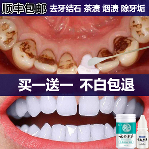 去除牙垢牙结石牙膏