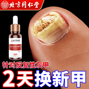 灰指甲专用液脱甲膏增厚灰甲净脚趾甲药膏软甲旗舰店抑菌治疗正品