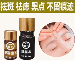 去痣点痣药水无痕正品点斑水身体脸部雀斑修复液防疤黑点祛痣膏