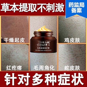 腿上有鸡皮疙瘩毛孔堵塞疏通去鸡皮肤疙瘩毛囊角化药膏儿童成人霜