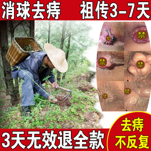 痔疮膏消肉球女性痔根断挖根华佗痣疮止痒男断痔痔苍膏去肉球正品