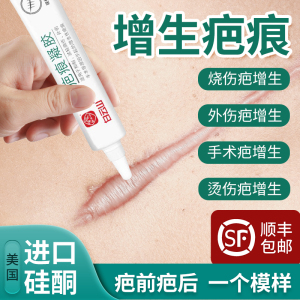 增生疤痕凸起修复膏