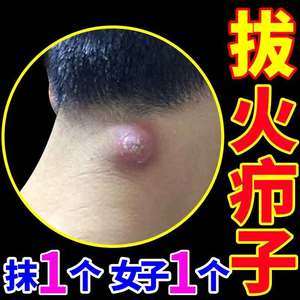断痒拔毒膏贴吸脓外用正品治火疖子皮脂腺坐板疮拔脓神器买二送一