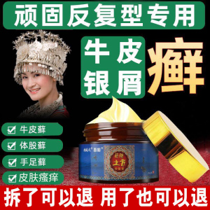 牛皮鲜银屑癣药膏正品苗家皮肤瘙痒外用杀菌顽固性皮癣抑菌止痒膏