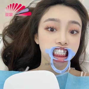 牙科纳米釉质c型开口器带翼口撑牙齿冷光美白专用带柄拉钩扩口器