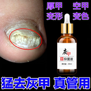 匠宜益生灰指甲姿迪凤仙花灰指甲抑菌液甲资迪康灰速达灰指甲凝胶