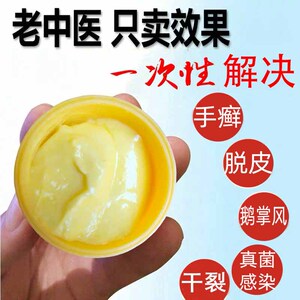 治疗鹅掌风手癣手气膏真菌感染手上手足藓蜕脱皮干裂水泡止痒药膏