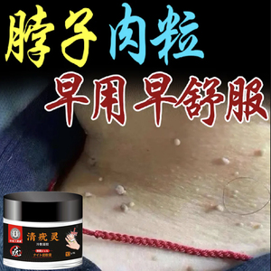 003人付款天猫苗凤凰瘊优平猴子刺瘊子疙瘩肉刺鸡眼尤跖疣扁平疣尖锐