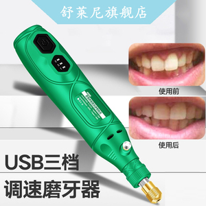 新品磨牙神器大人牙科打磨机电动小型磨牙器修牙齿磨平工具牙抛光