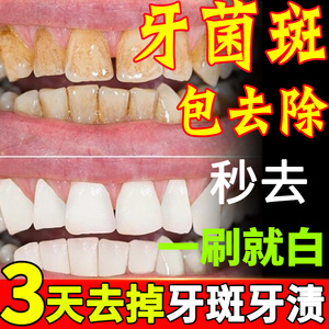 日本汉方牙斑净牙齿美白速效去黄牙擦烟茶渍牙菌斑洗污垢祛除神器