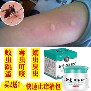 跳蚤咬蚊虫叮咬止痒消红肿药膏蚊子臭虫咬儿童成人皮肤过敏外用药