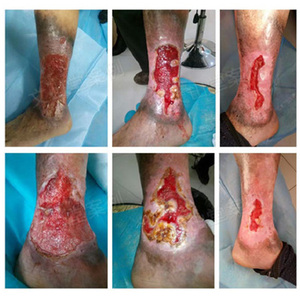 99你我的原生态淘宝长皮生肌散促进长肉伤口结痂快速愈合 消 炎 粉