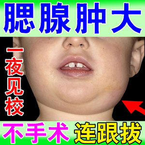 儿童腮腺贴痄腮贴淋巴肿大扁桃炎体颈部下颚腮帮子疼痛消除神器