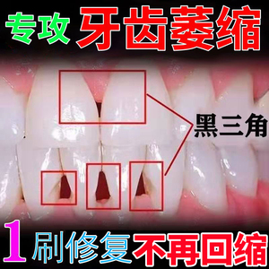 牙龈萎缩修复再生专用牙膏治牙齿退缩黑三角牙根暴露牙冠变长神器