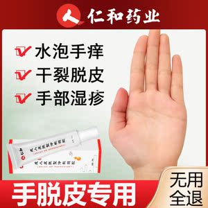 手脱皮手藓真菌感染手上干裂蜕皮烂手治手裂的专用手气鹅掌风药膏