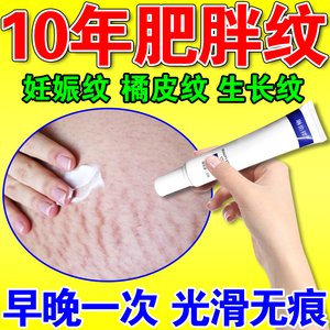 大腿肥胖纹消除修复霜