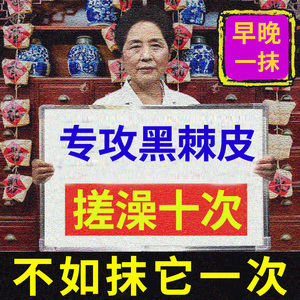 黑棘皮病脖子黑黑的去黑色素沉淀症去除洗不干净治疗后颈药膏cc