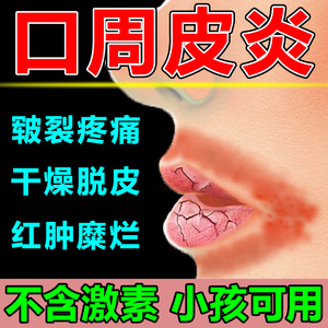 唇炎专用口周皮炎药膏成人儿童烂嘴角口角炎嘴唇疱疹干裂疼痛用