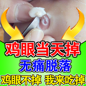 【鸡眼必消】鸡贴眼治疗脚底老茧走路疼小时达水非修鸡眼刀膏药帖