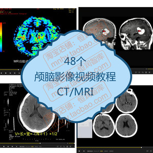 颅脑影像视频教程CT读片核磁共振诊断脑部头颅MRI分析头部鉴别MR