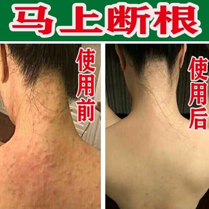 画皮软膏正品皮肤止痒栢百心堂草本抑菌乳膏恒丰正品康舒艾苗软膏