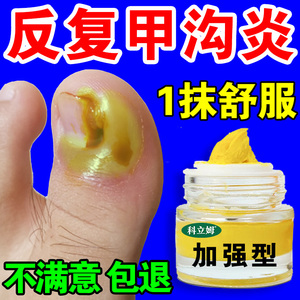 甲沟炎治疗专用药膏软甲消肿去肉芽脚趾止痛嵌甲扎肉化脓消炎神器