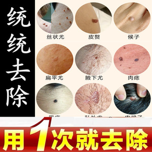 去除颈部小肉瘤肉猴子特傚治肉瘊子药膏脖子腋下肉粒老鼠痣0人付款56