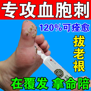 血胞刺去除膏去尤灵肉刺瘊子脚趾脚底手足部休子老茧软化神器