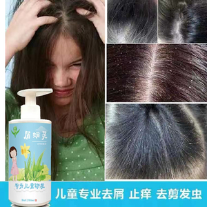 洗发水止痒去屑控油除头螨虫除虱子头皮问题剪发虫贝优杰旗舰店418