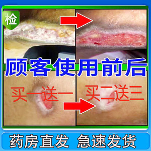 生肌膏老人褥创膏去腐创伤口快速愈合促进长肉老烂腿臀部膏正品