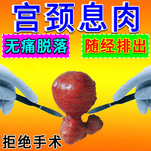 日本宫颈息肉贴子宫肌瘤囊肿子宫内膜息肉宫颈囊肿月经不调中药贴